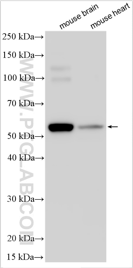 Western Blot (WB) analysis of various lysates using SLC33A1 Polyclonal antibody (26548-1-AP)