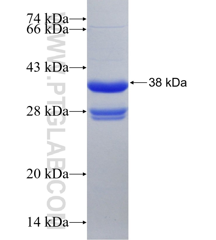 SLC34A1 fusion protein Ag24807 SDS-PAGE