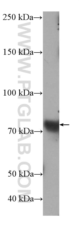 Western Blot (WB) analysis of HEK-293 cells using SLC34A2 Polyclonal antibody (21295-1-AP)