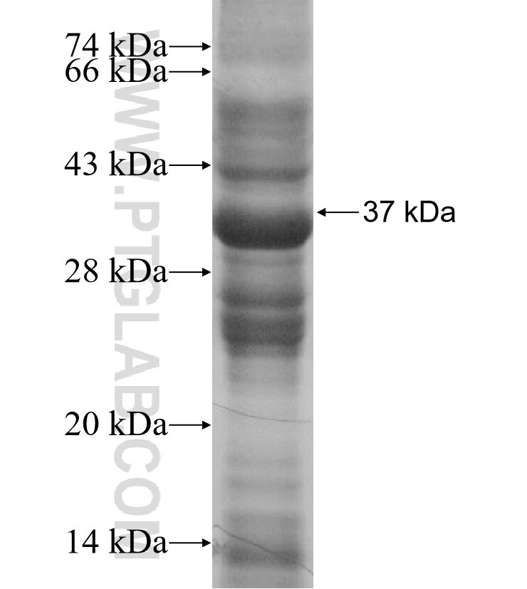 SLC34A2 fusion protein Ag15846 SDS-PAGE