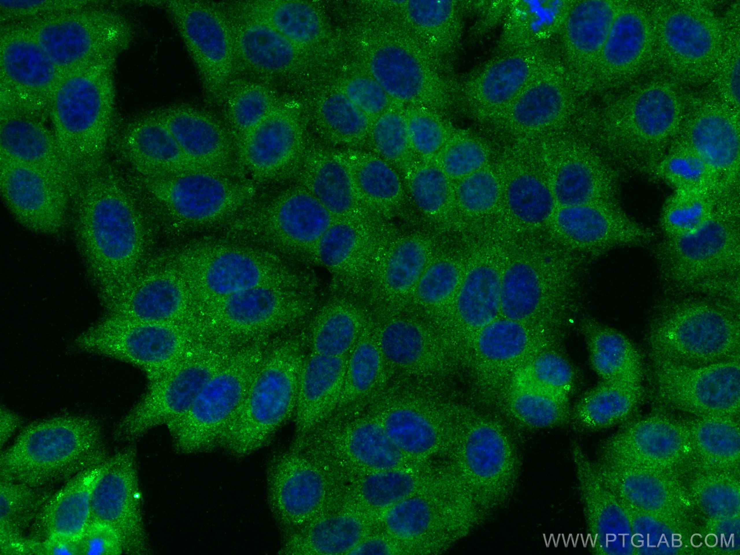 Immunofluorescence (IF) / fluorescent staining of HepG2 cells using SLC35A1 Polyclonal antibody (16342-1-AP)