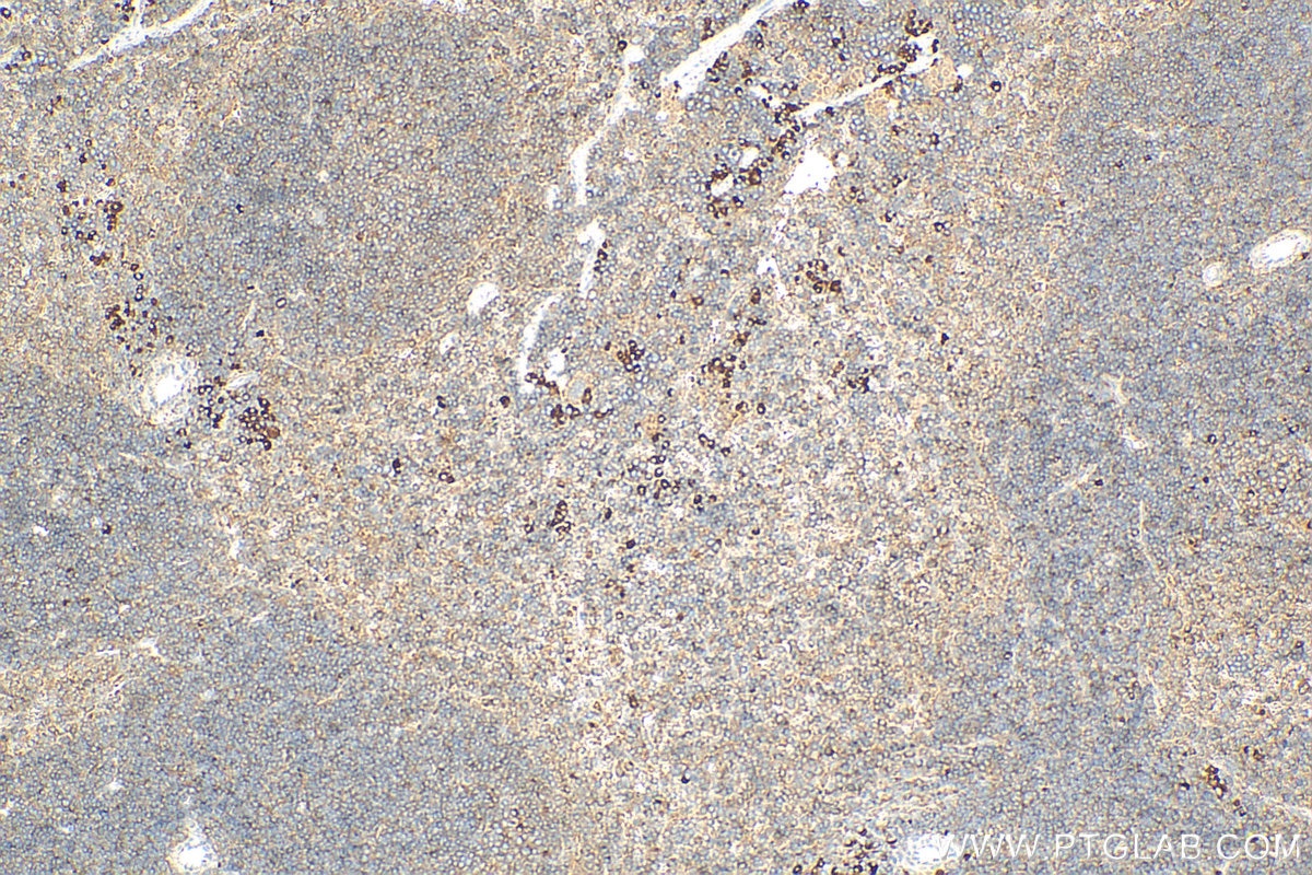 Immunohistochemistry (IHC) staining of mouse spleen tissue using SLC35A1 Polyclonal antibody (16342-1-AP)