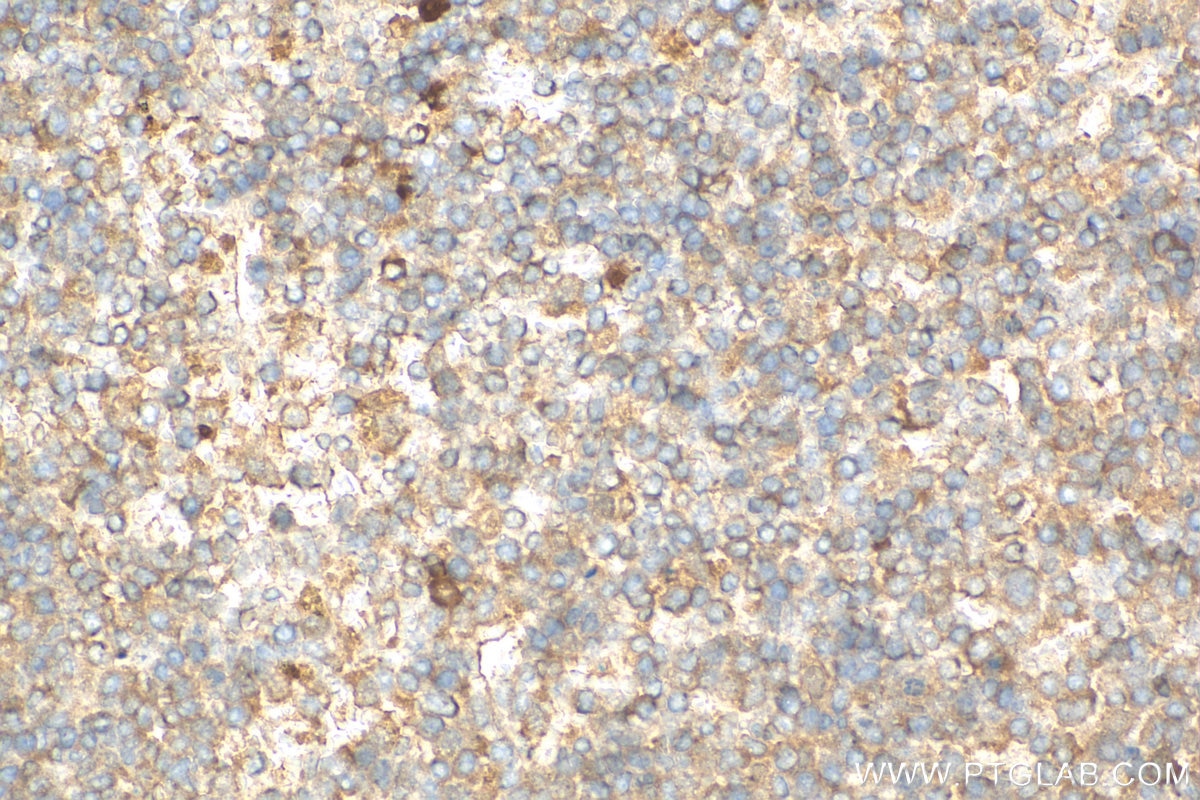 Immunohistochemistry (IHC) staining of mouse spleen tissue using SLC35A1 Polyclonal antibody (16342-1-AP)