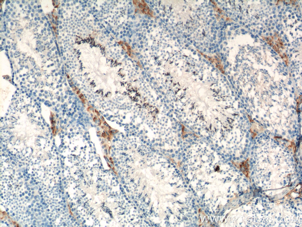 Immunohistochemistry (IHC) staining of mouse testis tissue using SLC35A1 Polyclonal antibody (16342-1-AP)
