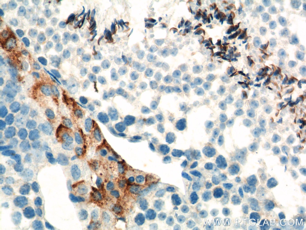 Immunohistochemistry (IHC) staining of mouse testis tissue using SLC35A1 Polyclonal antibody (16342-1-AP)