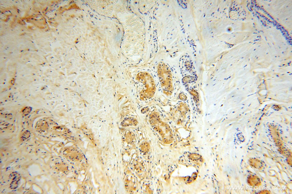 Immunohistochemistry (IHC) staining of human skin tissue using SLC35A1 Polyclonal antibody (16342-1-AP)