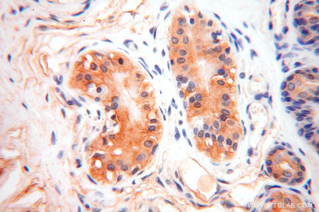 Immunohistochemistry (IHC) staining of human skin tissue using SLC35A1 Polyclonal antibody (16342-1-AP)