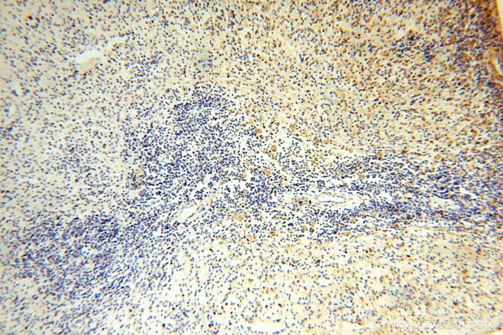 Immunohistochemistry (IHC) staining of human spleen tissue using SLC35A1 Polyclonal antibody (16342-1-AP)