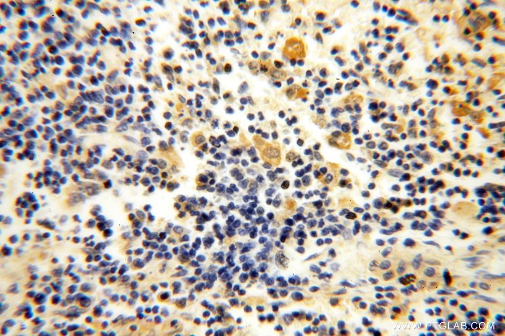 Immunohistochemistry (IHC) staining of human spleen tissue using SLC35A1 Polyclonal antibody (16342-1-AP)