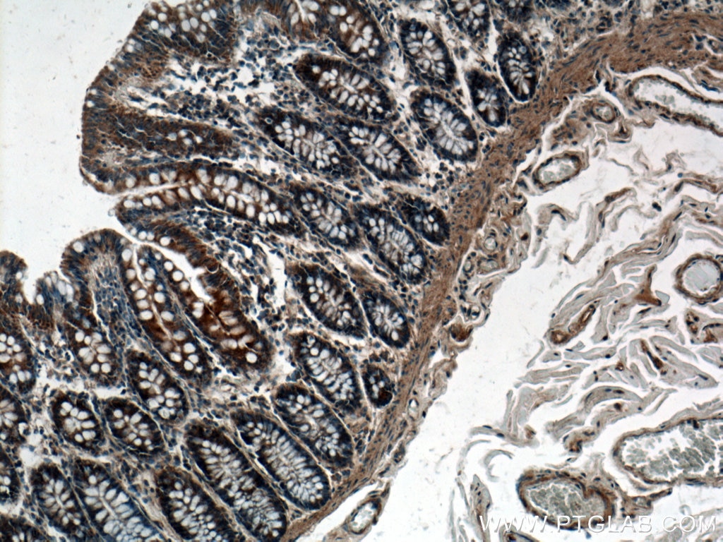 Immunohistochemistry (IHC) staining of human colon tissue using SLC35A2 Polyclonal antibody (13657-1-AP)