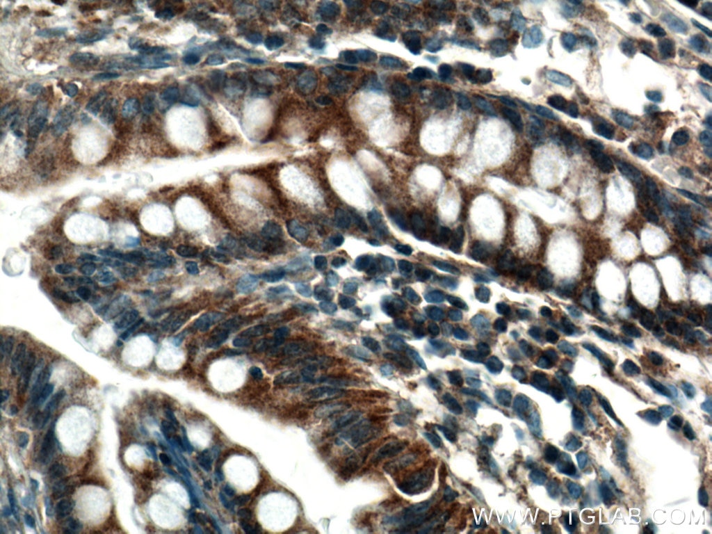 Immunohistochemistry (IHC) staining of human colon tissue using SLC35A2 Polyclonal antibody (13657-1-AP)