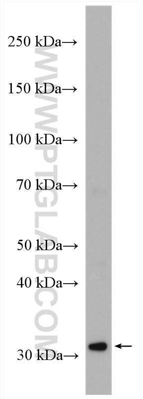 Western Blot (WB) analysis of mouse brain tissue using SLC35A2 Polyclonal antibody (13657-1-AP)