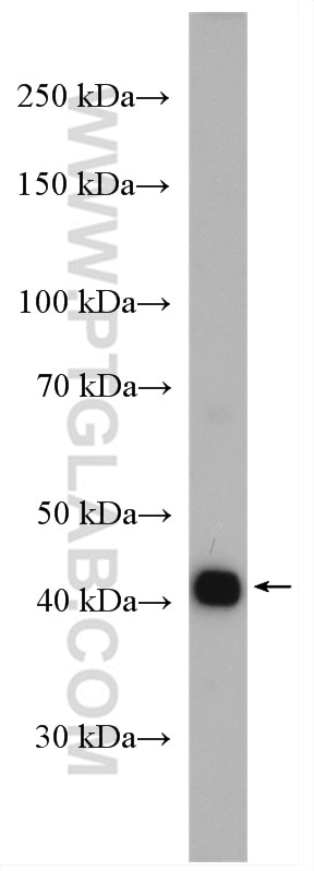 Western Blot (WB) analysis of HEK-293 cells using SLC35A2 Polyclonal antibody (13657-1-AP)
