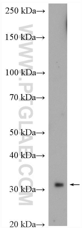 SLC35A3