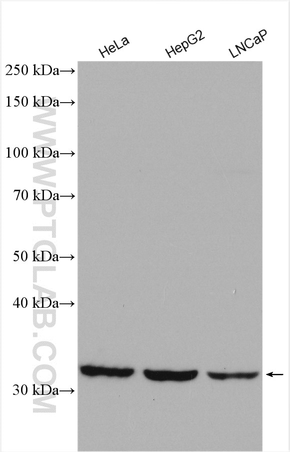Western Blot (WB) analysis of various lysates using SLC35A3 Polyclonal antibody (26874-1-AP)