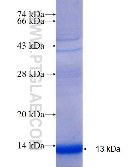 SLC35A3 fusion protein Ag25468 SDS-PAGE