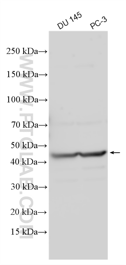 Various lysates were subjected to SDS PAGE followed by western blot with 33755-1-AP (SLC35A5 antibody) at dilution of 1:2000 incubated at room temperature for 1.5 hours. Western Blot (WB) analysis of various lysates using SLC35A5 Polyclonal antibody (33755-1-AP)