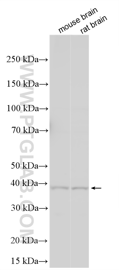 WB analysis using 17694-1-AP Western Blot (WB) analysis of various lysates using SLC35F1 Polyclonal antibody (17694-1-AP)