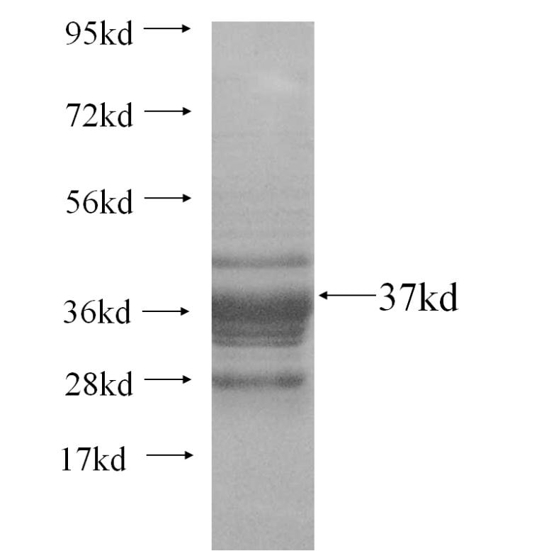 SLC35F1 fusion protein Ag11885 SDS-PAGE