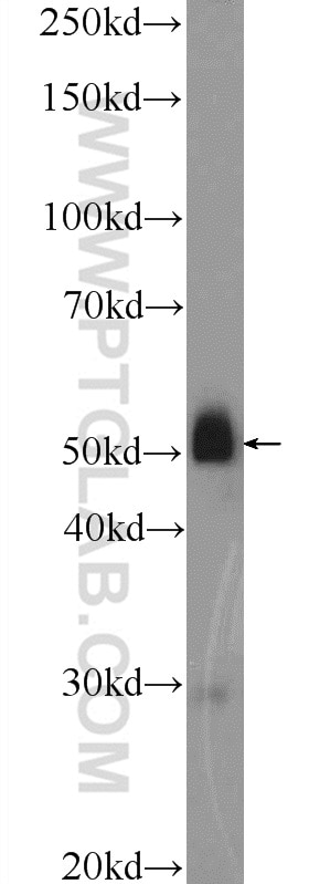 Western Blot (WB) analysis of mouse brain tissue using SLC35F2 Polyclonal antibody (25526-1-AP)