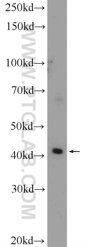 Western Blot (WB) analysis of A549 cells using SLC35F2 Polyclonal antibody (25526-1-AP)