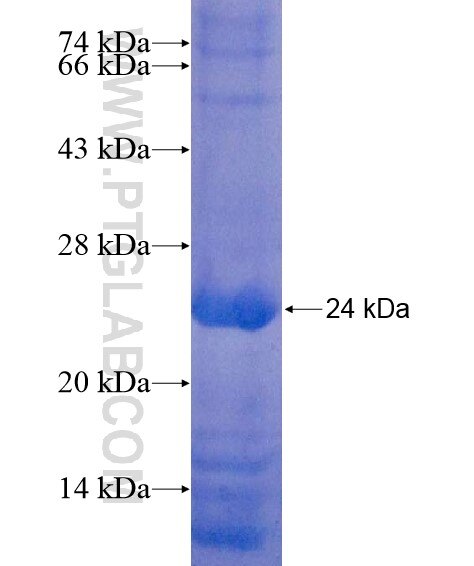 SLC35F2 fusion protein Ag20901 SDS-PAGE