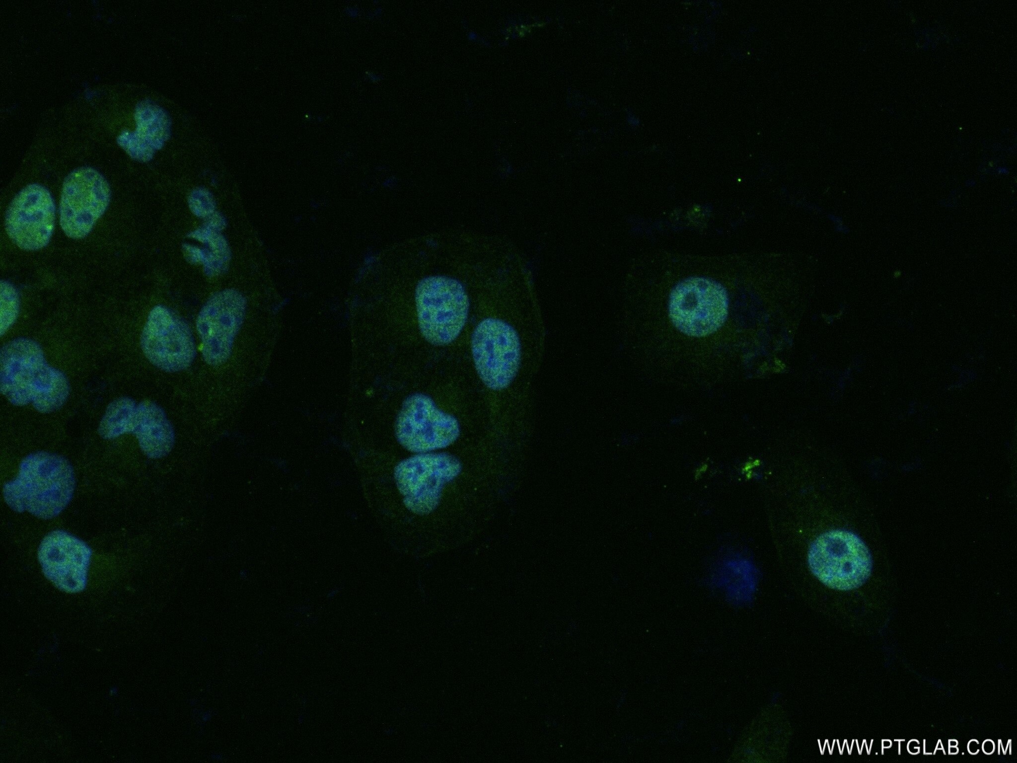 Immunofluorescence (IF) / fluorescent staining of U2OS cells using SLC35F4 Recombinant antibody (83085-3-RR)