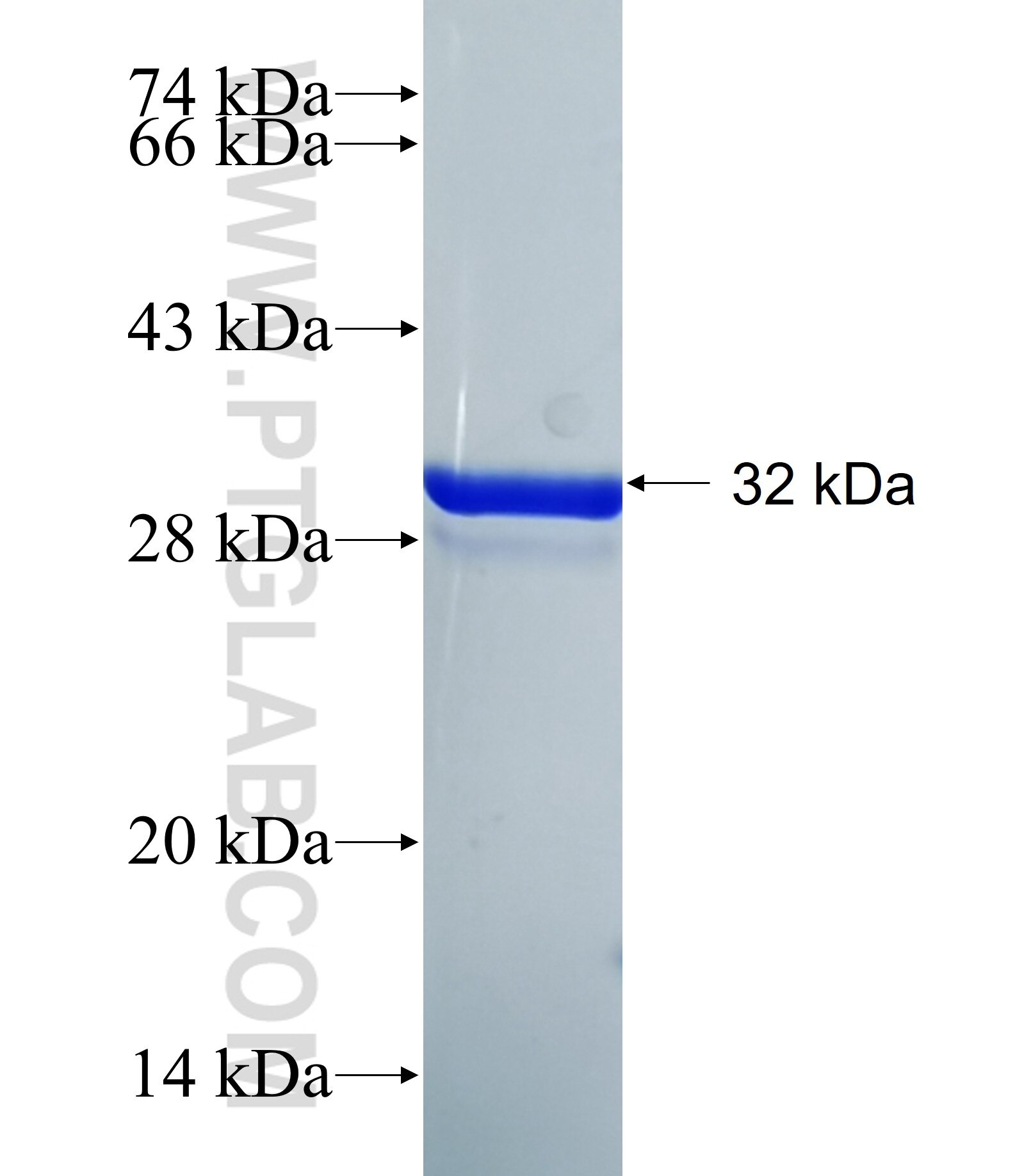 SLC35F6 fusion protein Ag40155 SDS-PAGE SLC35F6 fusion protein Ag40155 SDS-PAGE