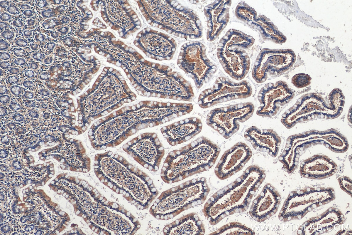 Immunohistochemistry (IHC) staining of human small intestine tissue using SLC36A1 Polyclonal antibody (24775-1-AP)