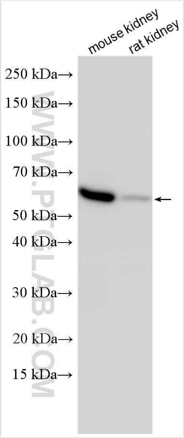 Western Blot (WB) analysis of various lysates using SLC36A2 Polyclonal antibody (21352-1-AP)