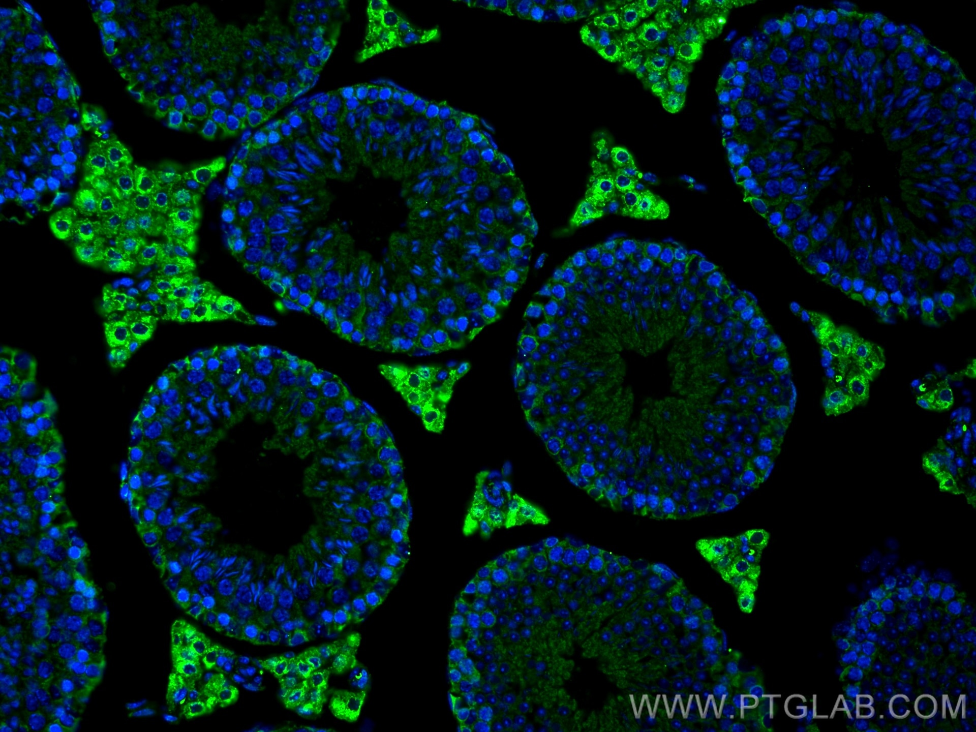 Immunofluorescence (IF) / fluorescent staining of mouse testis tissue using SLC36A3 Monoclonal antibody (67929-1-Ig)