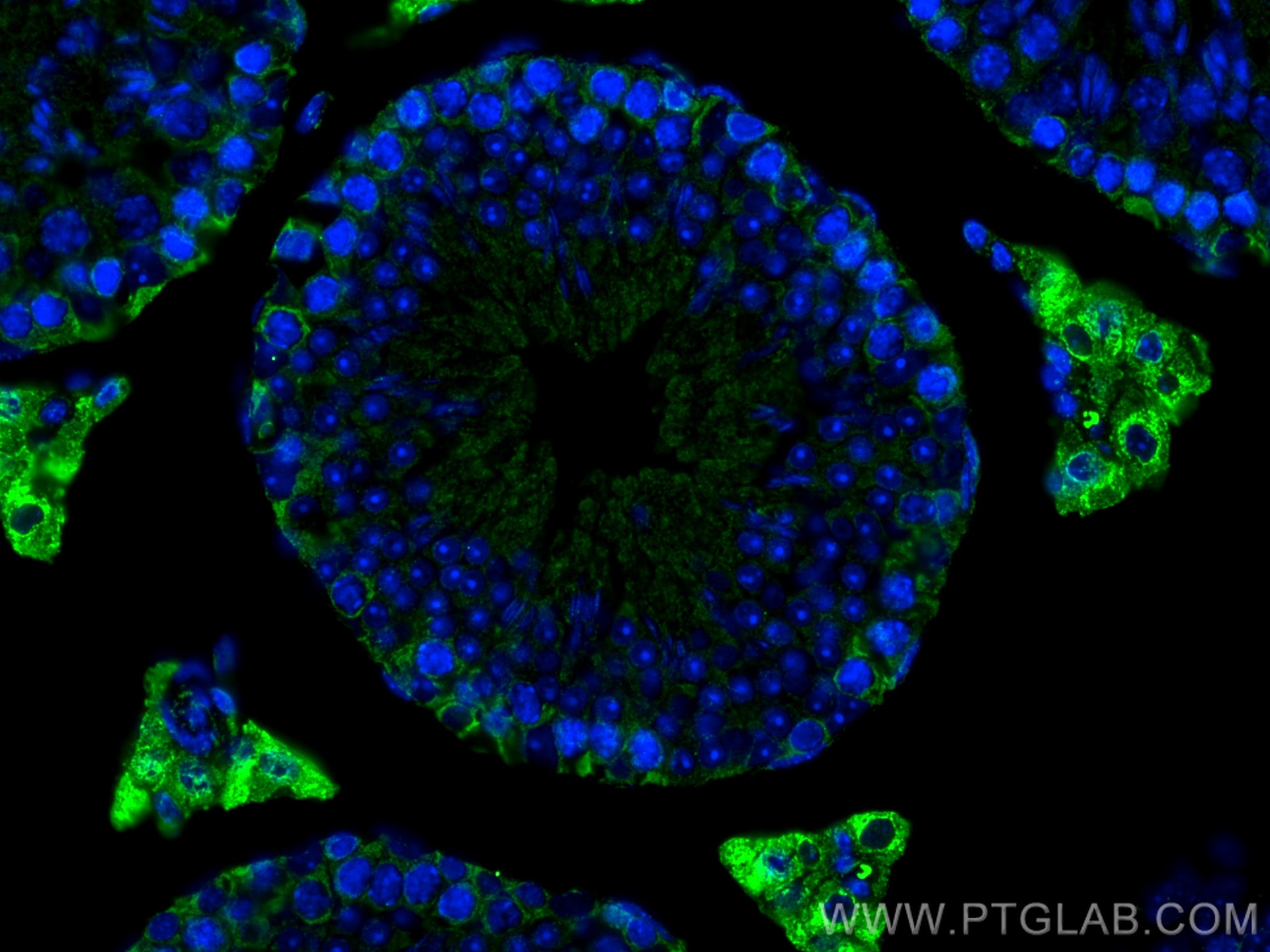 Immunofluorescence (IF) / fluorescent staining of mouse testis tissue using SLC36A3 Monoclonal antibody (67929-1-Ig)
