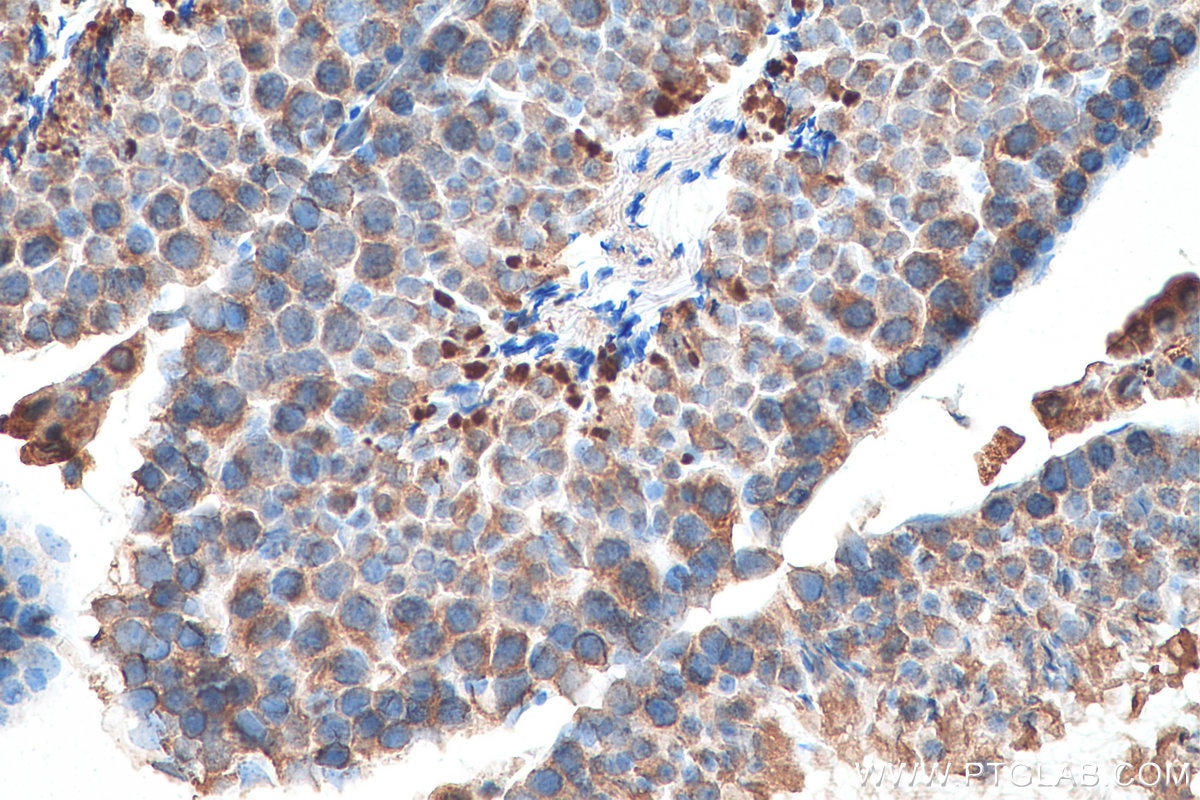 Immunohistochemistry (IHC) staining of mouse testis tissue using SLC36A3 Monoclonal antibody (67929-1-Ig)