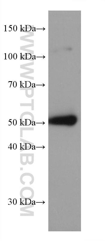 Western Blot (WB) analysis of mouse testis tissue using SLC36A3 Monoclonal antibody (67929-1-Ig)
