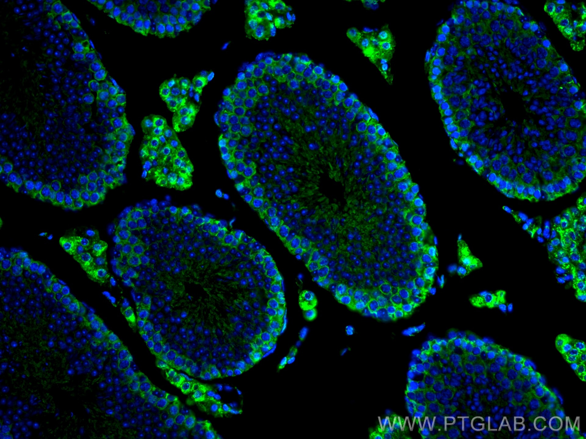 Immunofluorescence (IF) / fluorescent staining of mouse testis tissue using CoraLite® Plus 488-conjugated SLC36A3 Monoclonal a (CL488-67929)