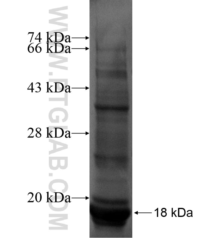 SLC36A3 fusion protein Ag16556 SDS-PAGE