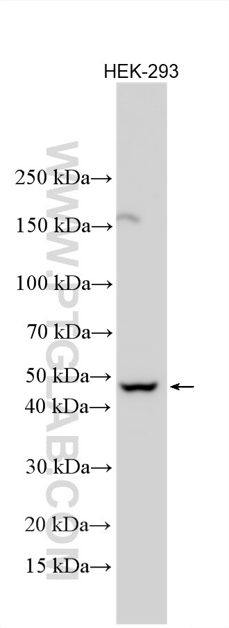 Western Blot (WB) analysis of various lysates using SLC36A4 Polyclonal antibody (24066-1-AP)