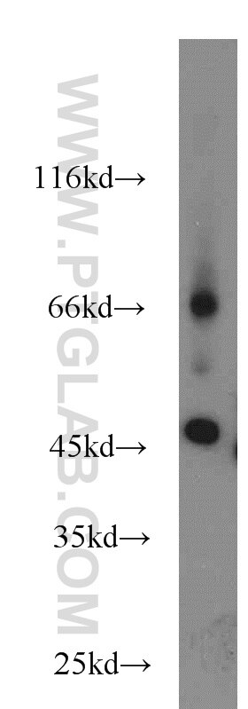 Western Blot (WB) analysis of HEK-293 cells using SLC36A4 Polyclonal antibody (24066-1-AP)