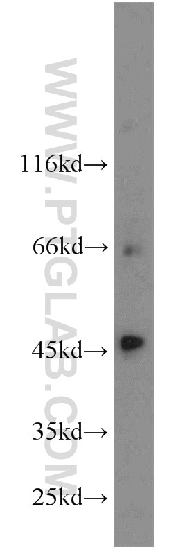 Western Blot (WB) analysis of PC-3 cells using SLC36A4 Polyclonal antibody (24066-1-AP)