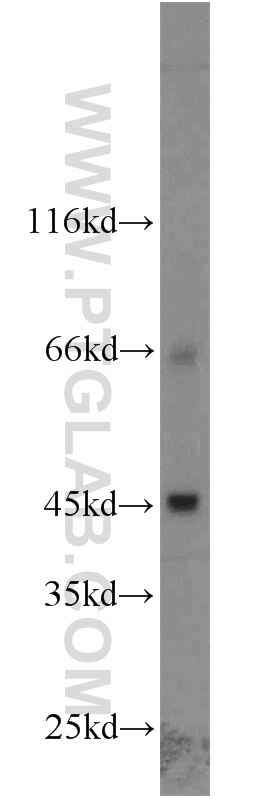 Western Blot (WB) analysis of A549 cells using SLC36A4 Polyclonal antibody (24066-1-AP)