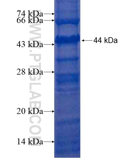 SLC36A4 fusion protein Ag21142 SDS-PAGE