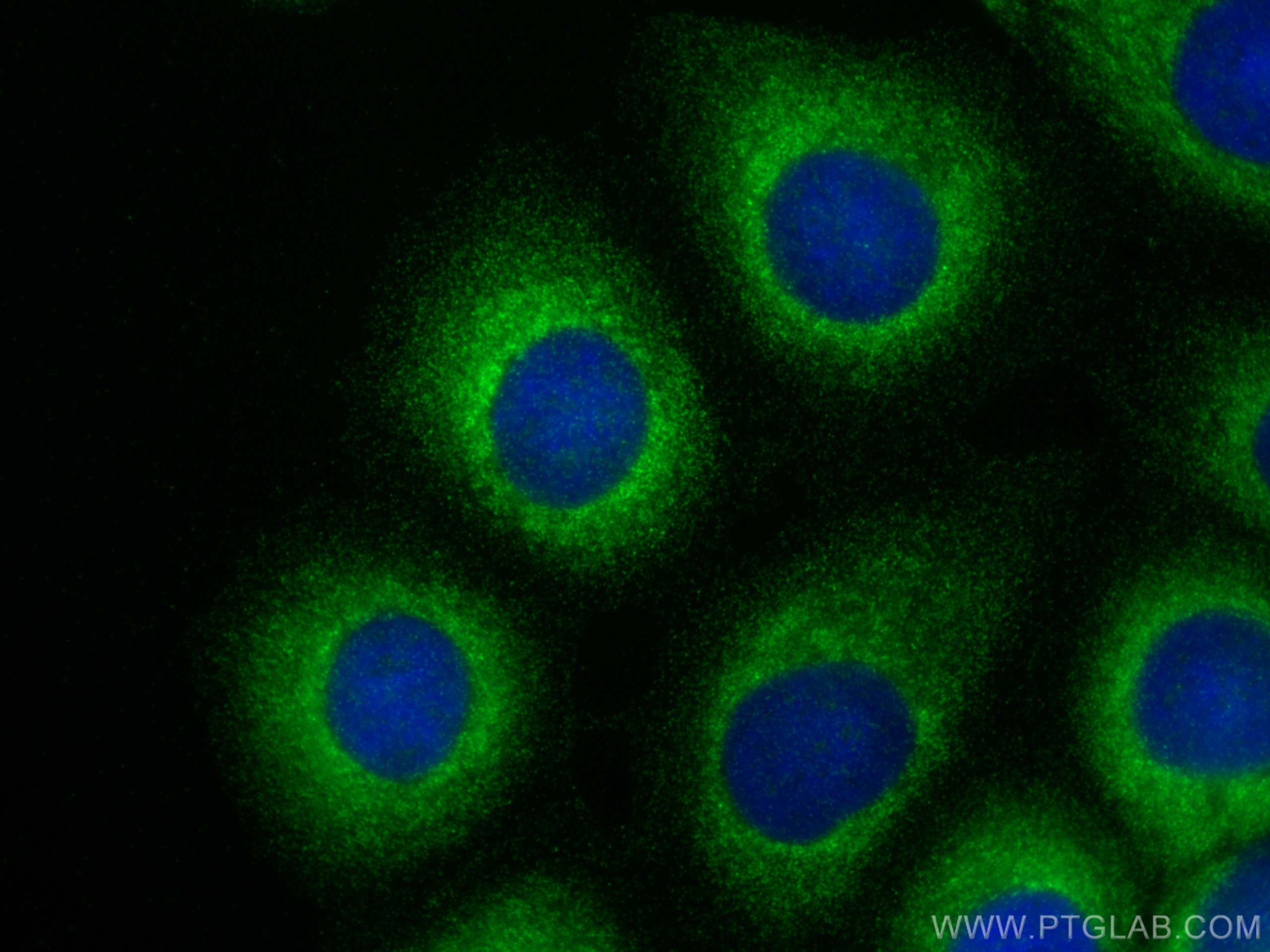 Immunofluorescence (IF) / fluorescent staining of MCF-7 cells using SLC37A1 Polyclonal antibody (24582-1-AP)