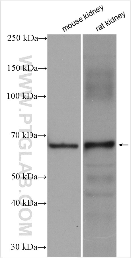 Western Blot (WB) analysis of various lysates using SLC37A1 Polyclonal antibody (24582-1-AP)