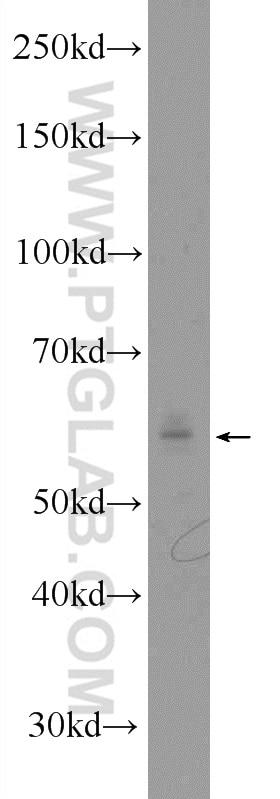 Western Blot (WB) analysis of MCF-7 cells using SLC37A1 Polyclonal antibody (24582-1-AP)