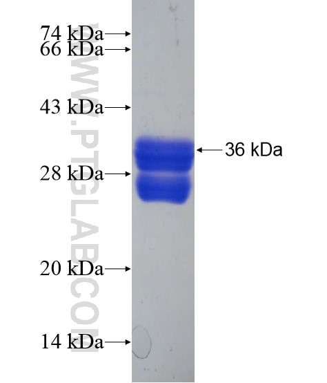SLC37A1 fusion protein Ag20180 SDS-PAGE