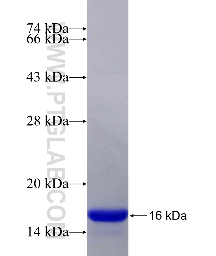 SLC37A1 fusion protein Ag20222 SDS-PAGE