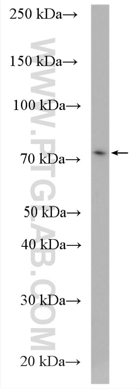 Western Blot (WB) analysis of RAW 264.7 cells using SLC37A2 Polyclonal antibody (20469-1-AP)