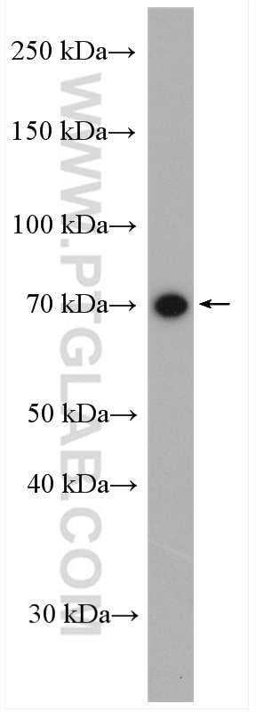 Western Blot (WB) analysis of mouse spleen tissue using SLC37A2 Polyclonal antibody (20469-1-AP)