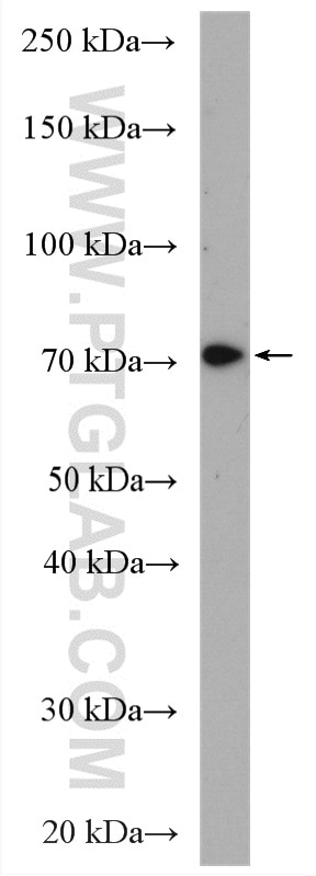 Western Blot (WB) analysis of mouse thymus tissue using SLC37A2 Polyclonal antibody (20469-1-AP)