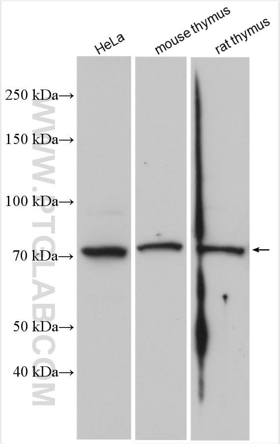 Western Blot (WB) analysis of various lysates using SLC37A2 Polyclonal antibody (20469-1-AP)